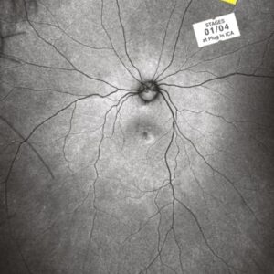 Supplement 3: The Invention and Conclusion of the Eye