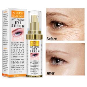 كريم معالج للعينين بحمض الهيالورونك من اليفر، يحتوي على الكولاجين المضاد لعلامات التقدم في السن، افضل جل للعيون، لازالة تجاعيد العين، الخطوط الدقيقة، الهالات السوداء، الانتفاخات (15 مل)