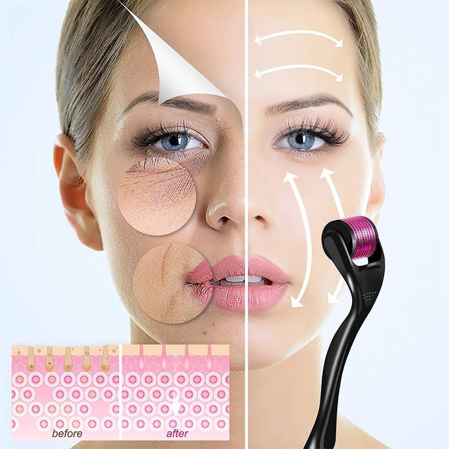 71cp3fHd4eL._AC_SL1500_ بكرة ابر دقيقة من جويز، 540 ابرة تيتانيوم للعناية بالبشرة للنساء والرجال، بكرة تجميل الوجه لمظهر شبابي مشرق، جهاز العناية بفروة الرأس وشعر الوجه، 0.5 ملم - الصورة 2